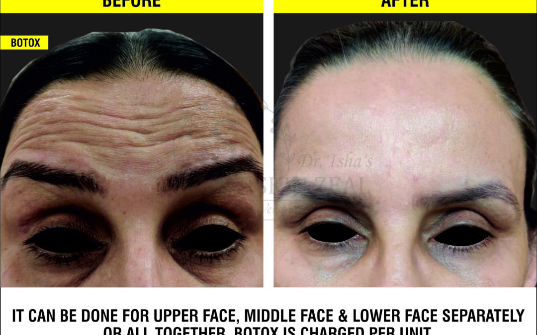 Pamper Your Skin With Anti-Aging Skin Treatments And Make It Gorgeous